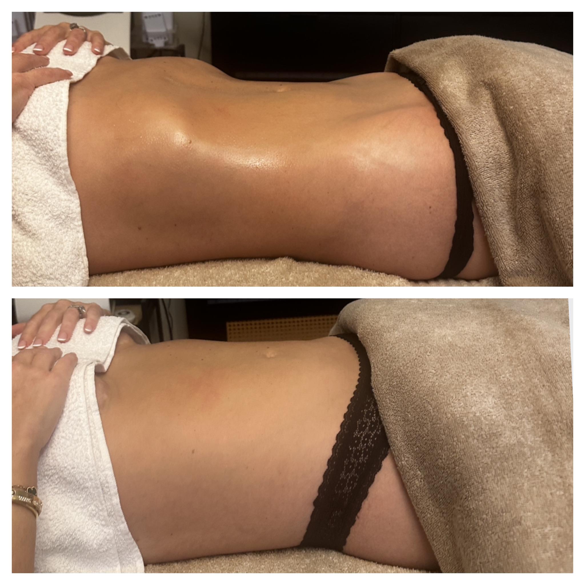 Restora Lymphatics & Body Reset