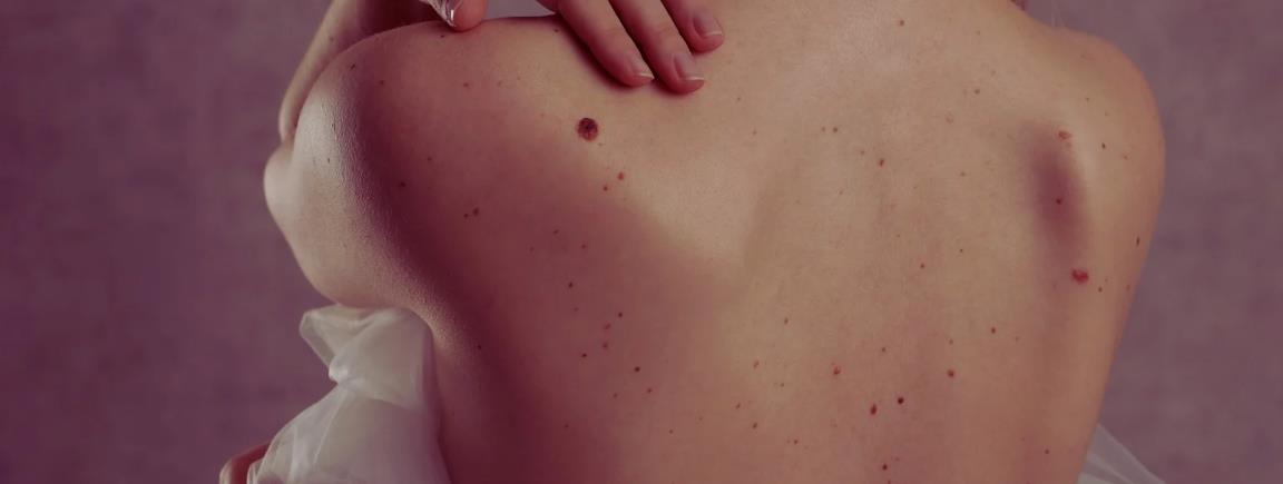 BARE Skin Surrey