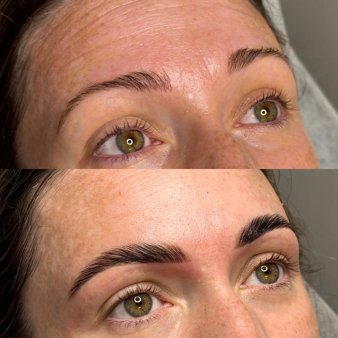 Brow Laine