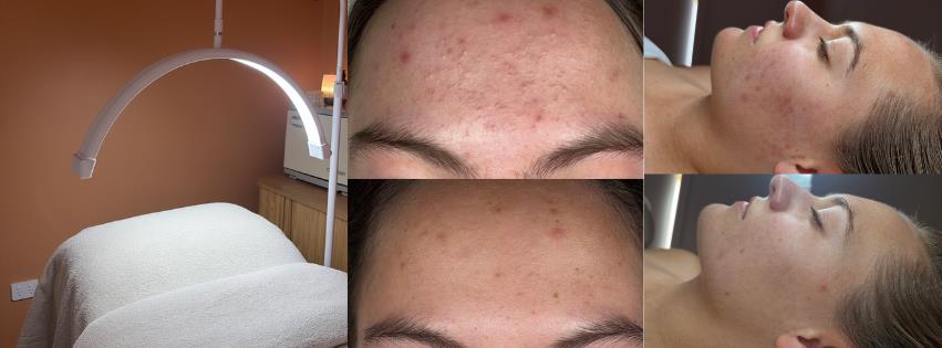 The Skin Carer